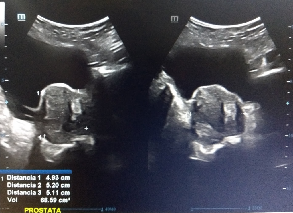 Dr. Ángel David Valdez Vargas es un reconocido especialista en Urología